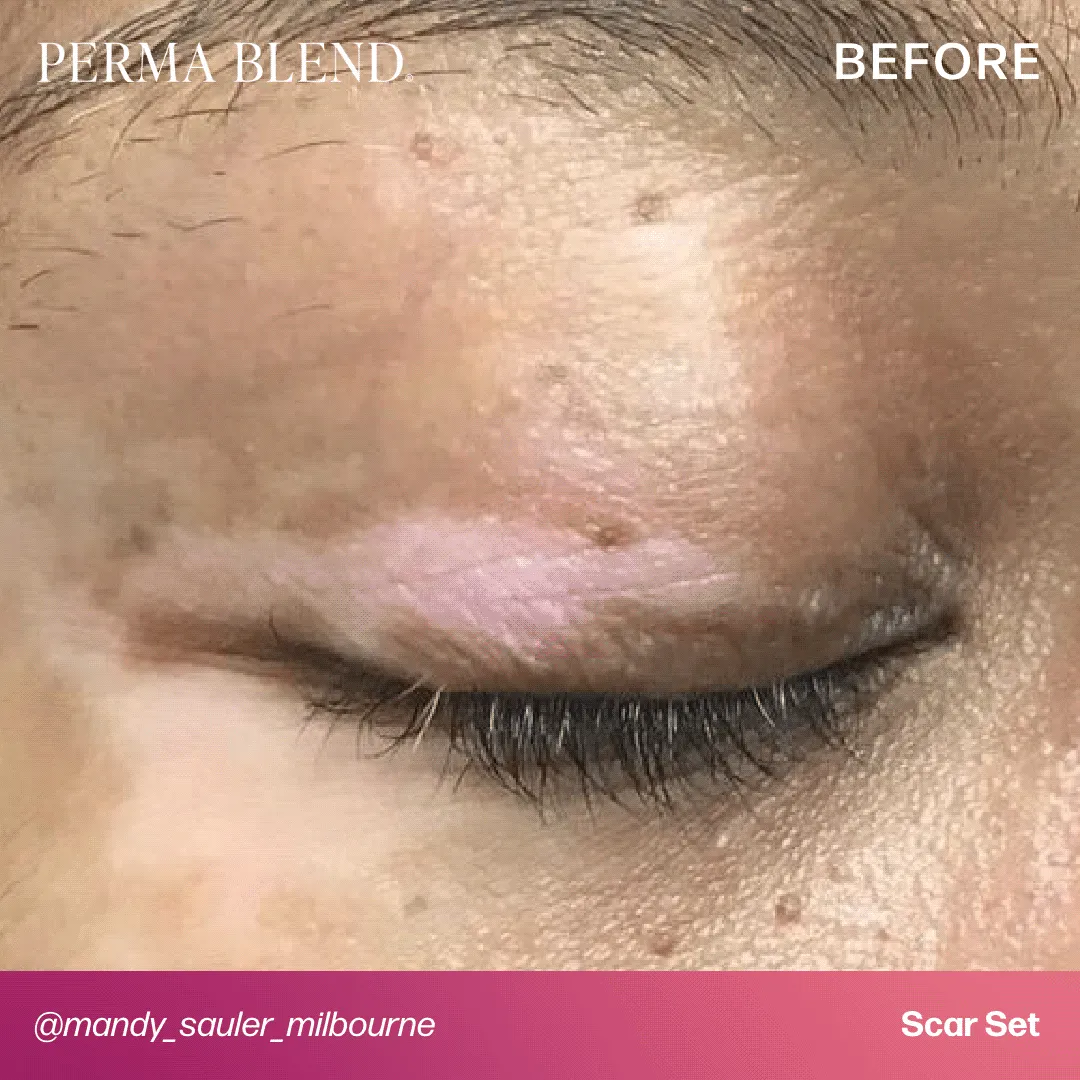 Mandy Sauler Scar Set